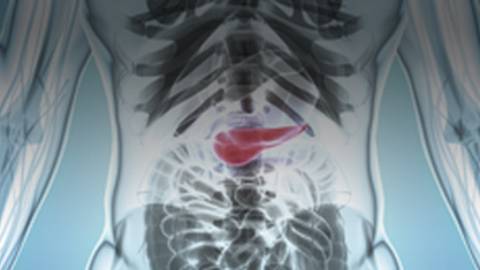 Pancreatic Cancer: Associated Signs, Symptoms, Risk Factors and Treatment Approaches