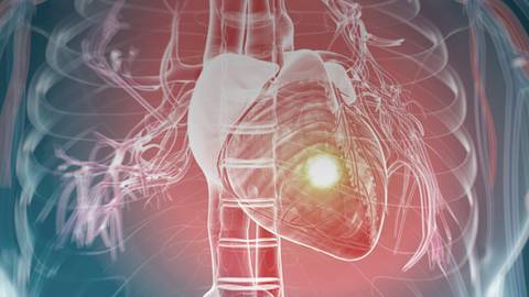 New Data, New Directions in Managing Patients with or at High Risk of ASCVD