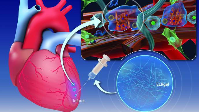 Hydrogel Injection May Change the Way the Heart Muscle Heals After a Heart Attack