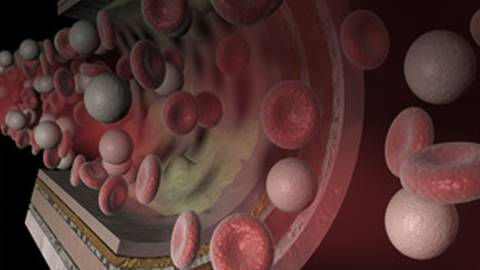 Clinicians Live: New Opportunities to Reduce Residual Risk Beyond Statin Therapy