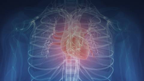 Gene Variations Guide Anticoagulation Strategies After Cardiac Catheterization