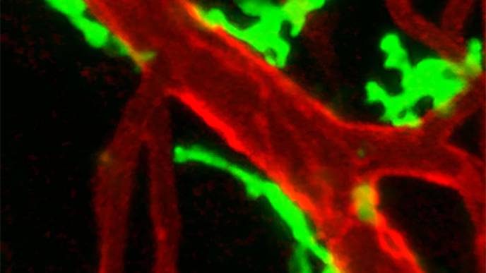Newly Discovered Immune Cell Function Vital to Healing