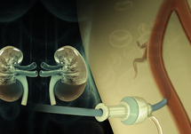 Current Experiences in Identifying and Treating Itch in Patients on Hemodialysis